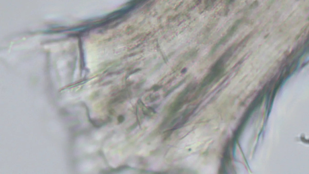 Damaged hair fiber microscopy